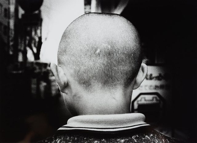 A black and white photo of the back of a child's shaved head