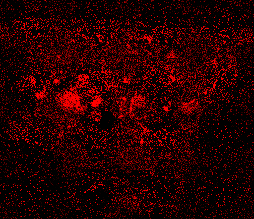 Calcium X-ray map. Image courtesy Timothy Rose