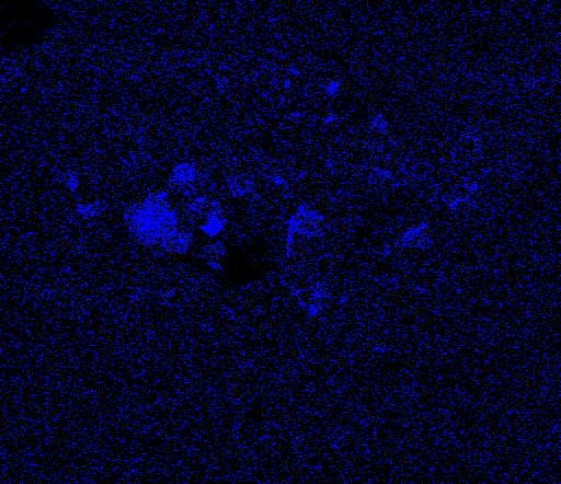 Phosphorous X-ray map. Image courtesy Timothy Rose