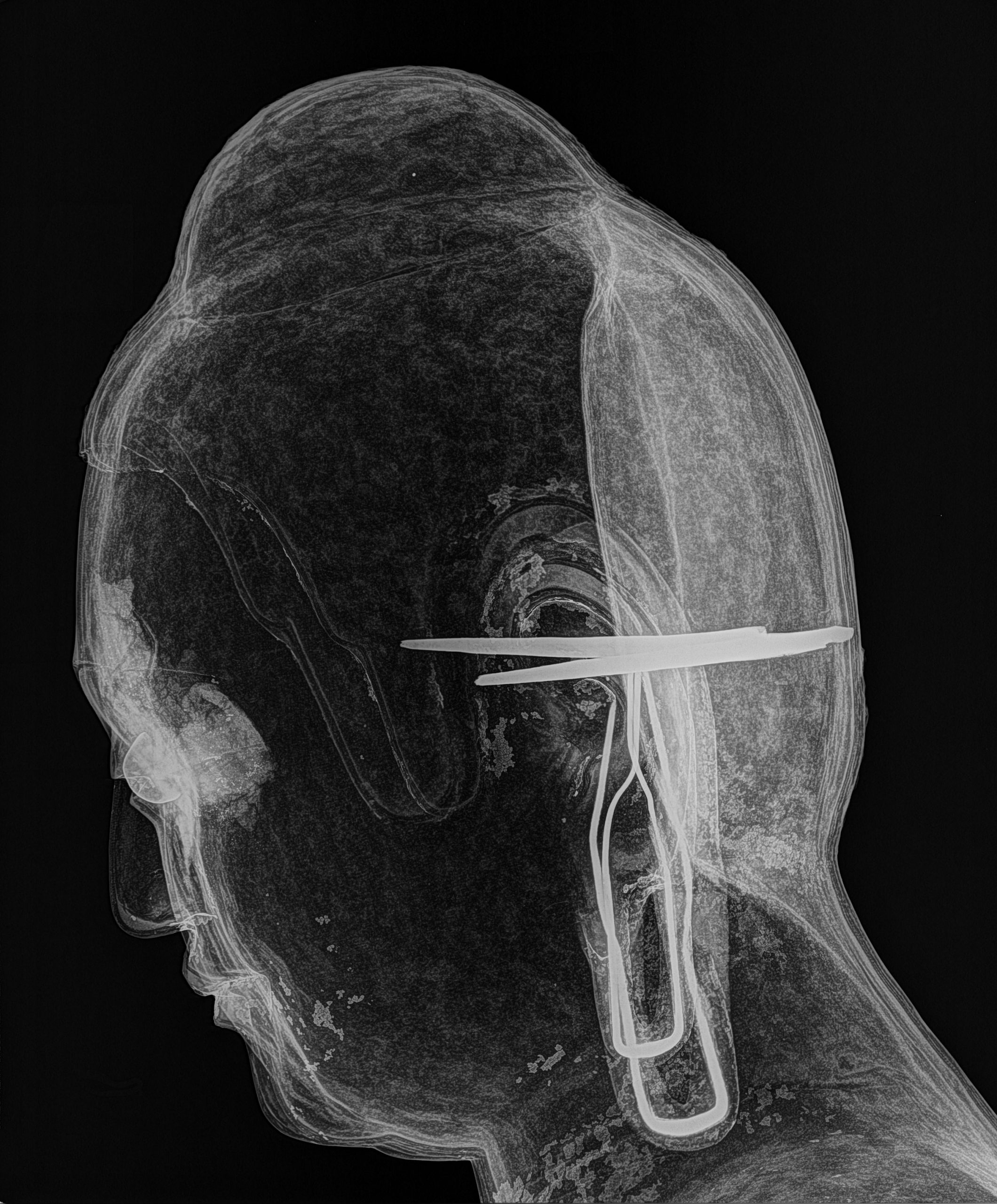 side view xray of the Met buffha