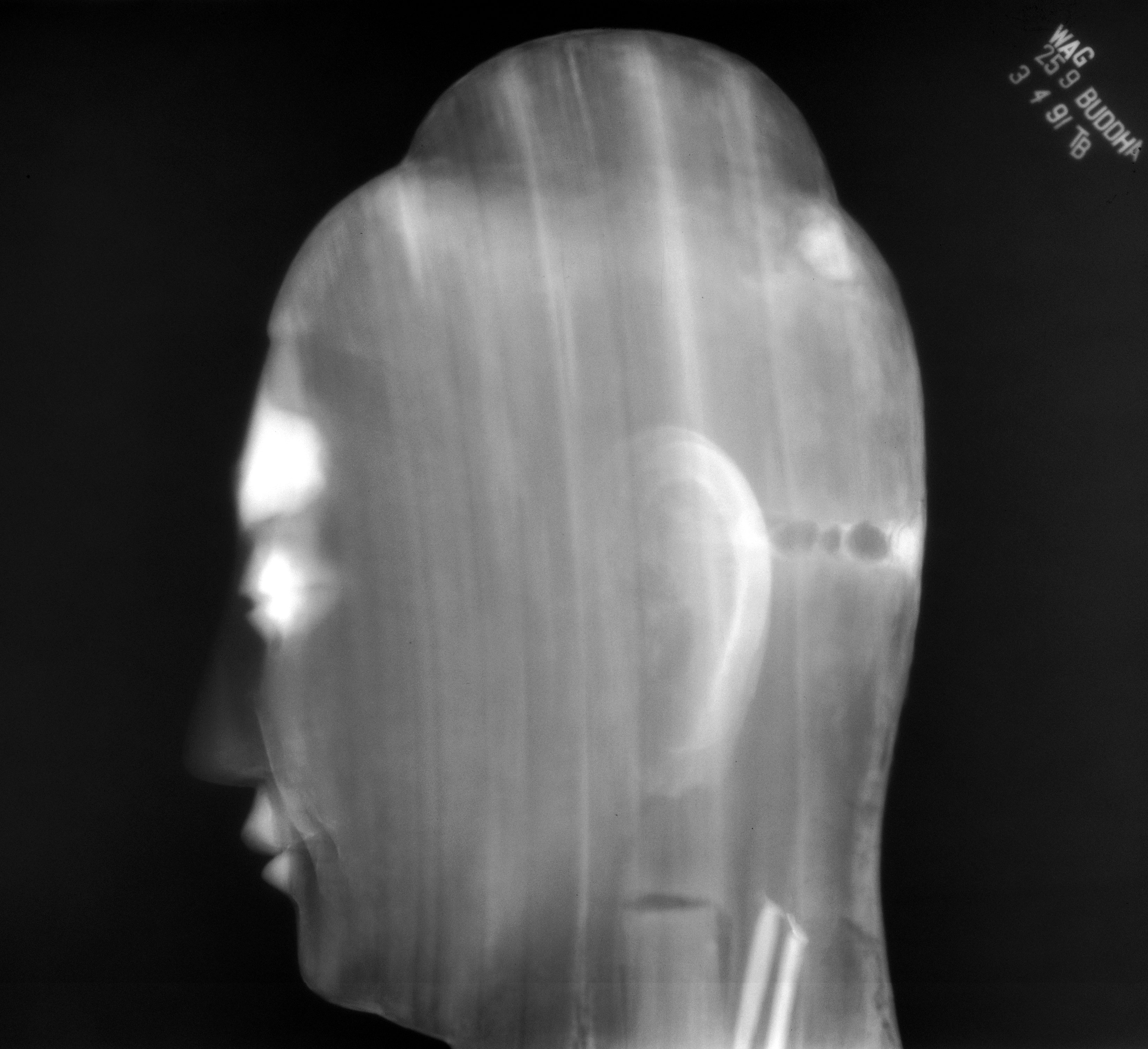 side view x ray